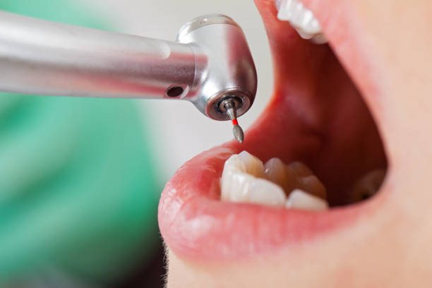 Best Emergency Dental Care for Sports Injuries in Biltmore Forest, NC